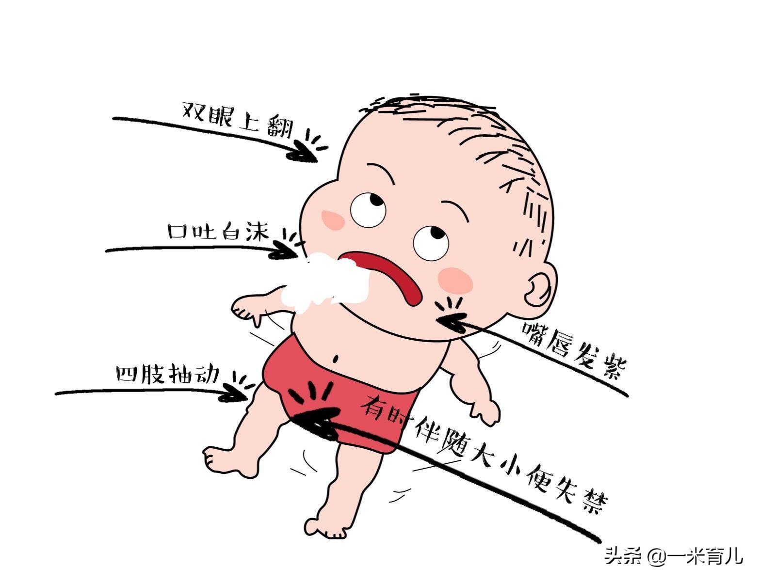 小儿癫痫莫要怕，规律服药、做好居家护理8要点，成长上学两不误