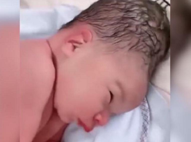 产妇用力不当胎儿头型会变吗,产妇用力不当导致胎儿头部畸形