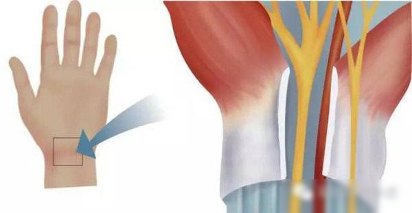 远离鼠标手，不妨试试用垂直鼠标吧！