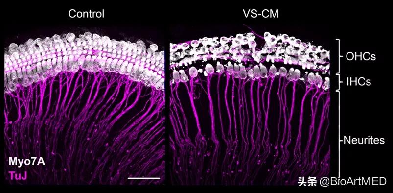 降压药疗效,降压药疗效好降压显著副作用又少