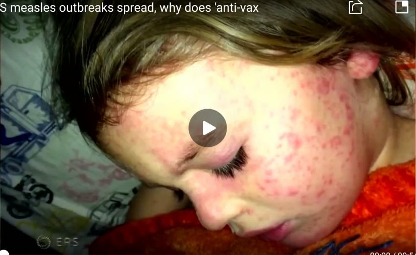 2亿人被它杀死，“灭绝”了20年突然卷土重来！美英法意可能潜伏着一场大危机......