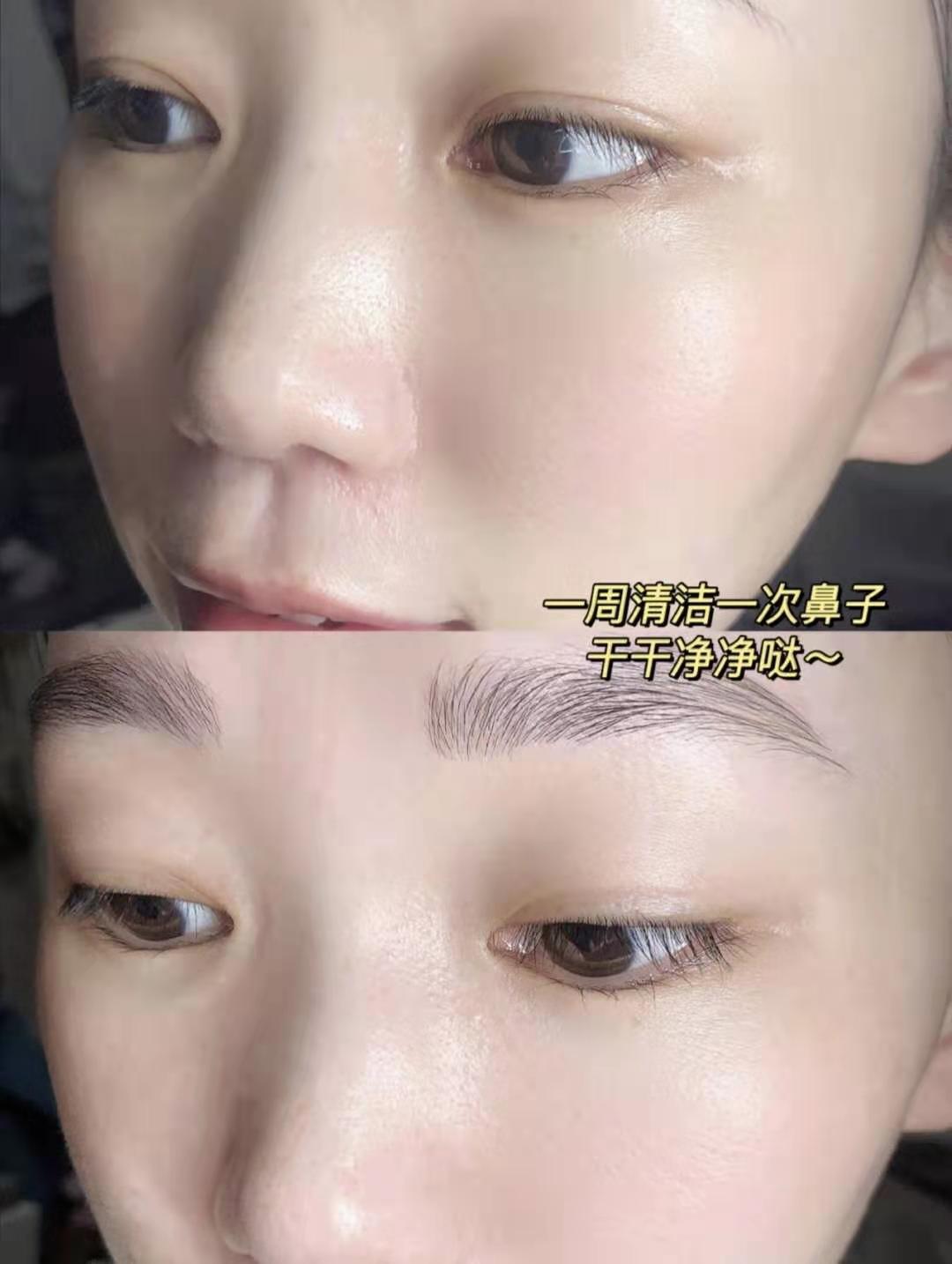 去黑头收缩毛孔的最好方法洗面奶,去黑头收缩毛孔的最好方法多少钱