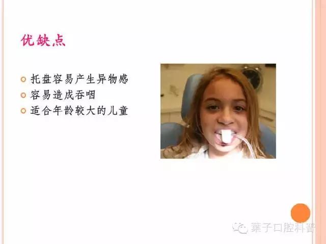 牙齿涂氟小知识,有氟牙可以涂氟吗