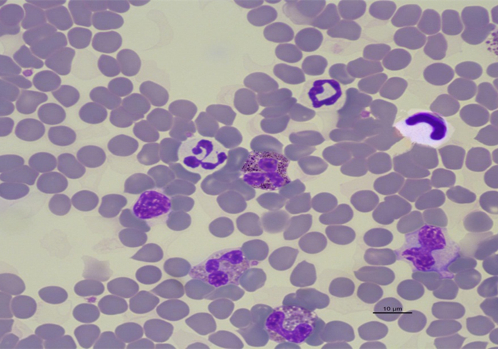 爱猫体检后发现白细胞增多就是有疾病？主因是猫压力过大