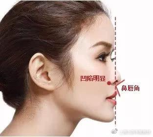 轻微嘴突正畸能达到正颌的效果吗,嘴歪正颌还是正畸怎么判断