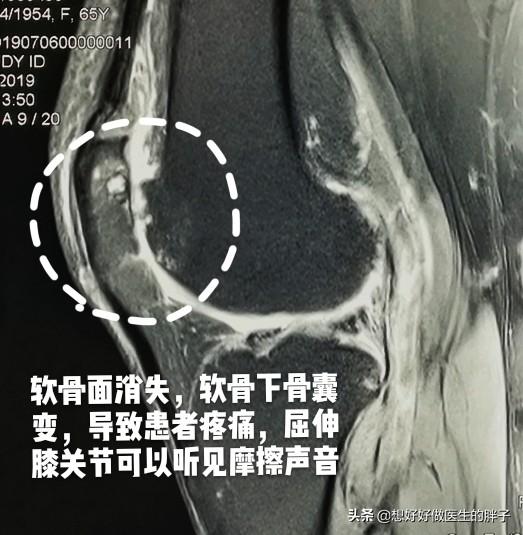 膝盖走路不怎么疼躺下就疼,儿童膝盖不动就不疼一走路就疼