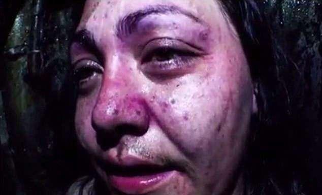 脸上长纤维瘤,父亲出走母亲改嫁,只剩弟弟却也车祸,我:做直播