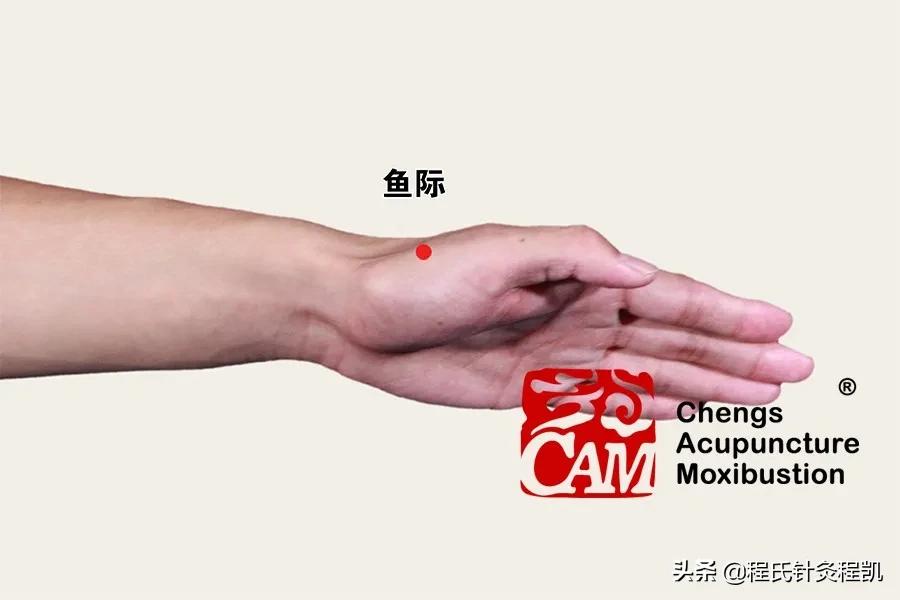 程凯针灸治疗糖尿病,程凯养生说糖尿病前期应注意什么