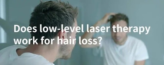 有了这个神器，英国人的脱发有救了？