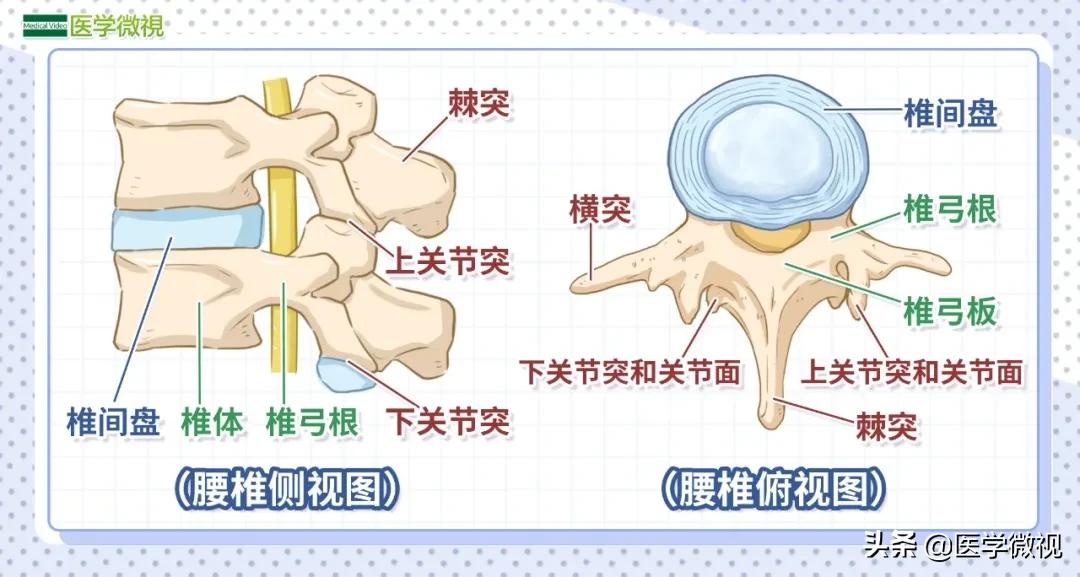 腰椎滑脱与腰椎间盘突出,腰椎间盘突出牵拉会不会造成滑脱