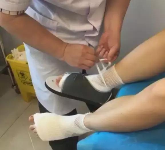 微创拇外翻手术有哪些后遗症,拇外翻微创手术效果好吗