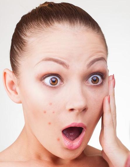 异维a酸和泰尔丝的区别,泰尔丝异维a酸软胶囊的副作用