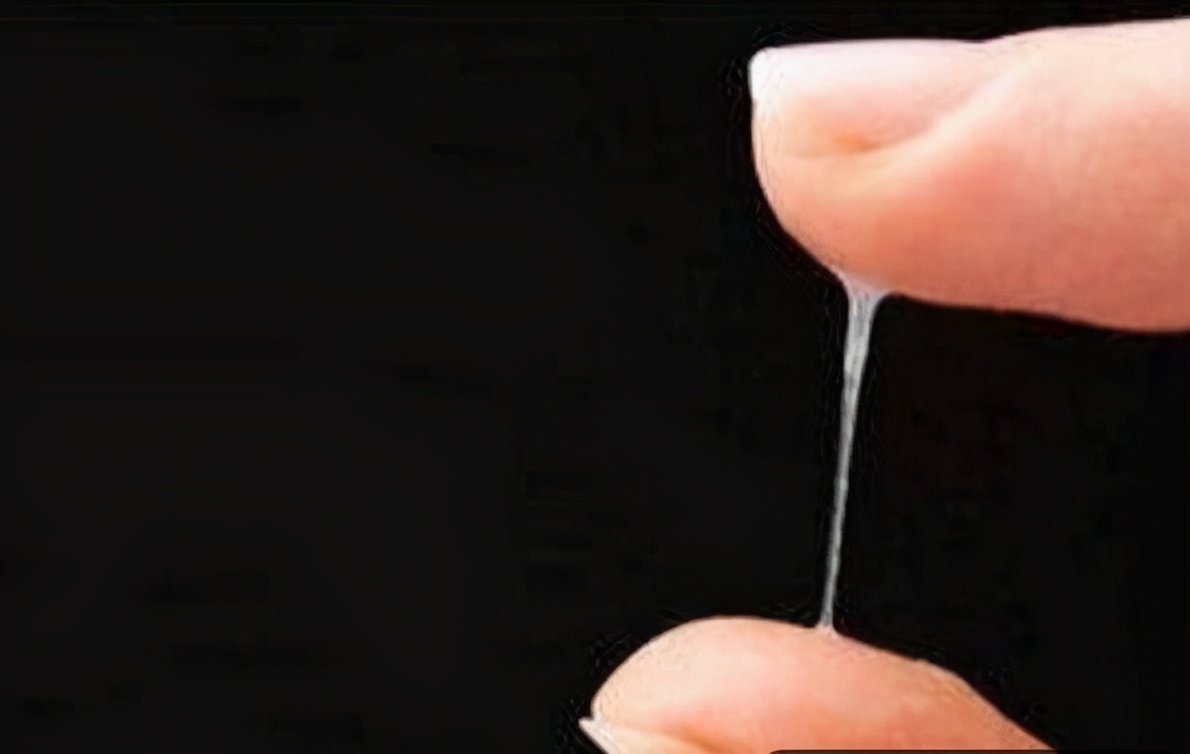 妇科炎症白带发黄怎么回事,妇科炎症白带像浆糊怎么治疗