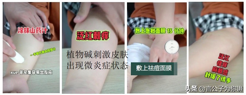 一叶子净痘润舒水,一叶子修复肌肤屏障