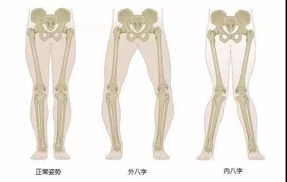 走路磨鞋底怎么办,走路总是磨鞋内侧什么原因