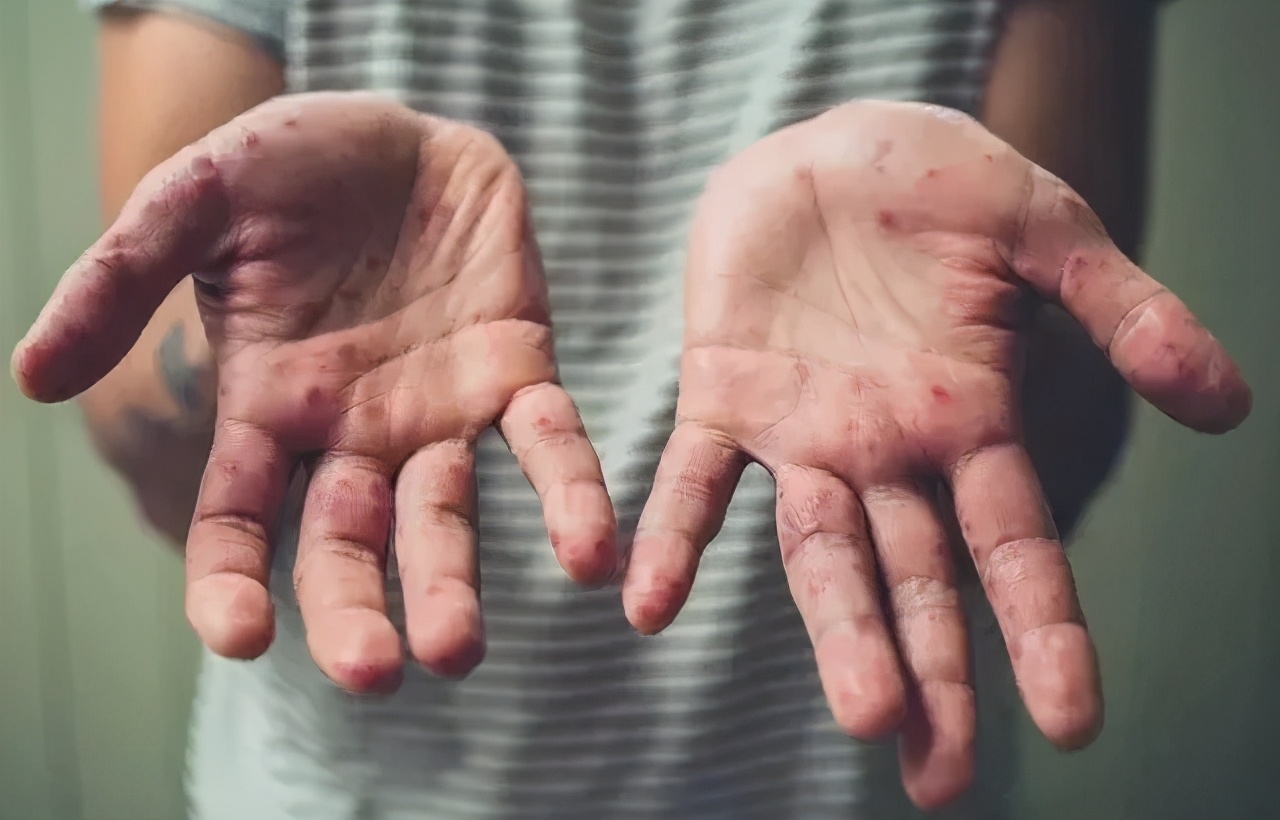 孩子突然发烧吃不下饭,小孩子发高烧喉咙沙哑说不出话