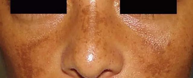 搴撳崥澹鏂戦潬璋卞悧,搴撳崥澹鐥樺ソ涓嶅ソ