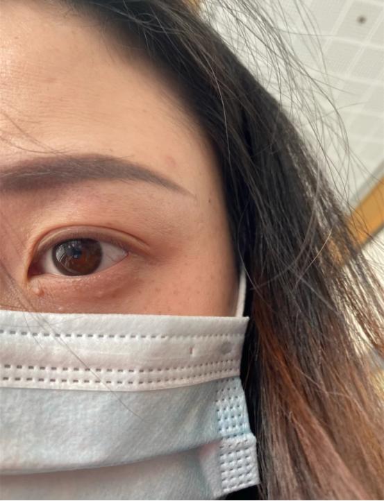 四大肌肤问题解决方案,四种肤质特点和解决方法