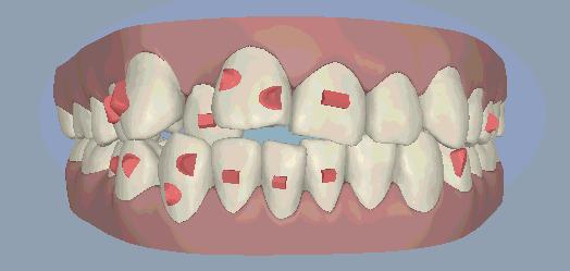 昊然弟弟全部图片,昊然弟弟视频
