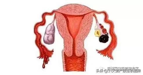 小腹坠胀感觉有东西要掉出来,小腹坠胀流了一点血