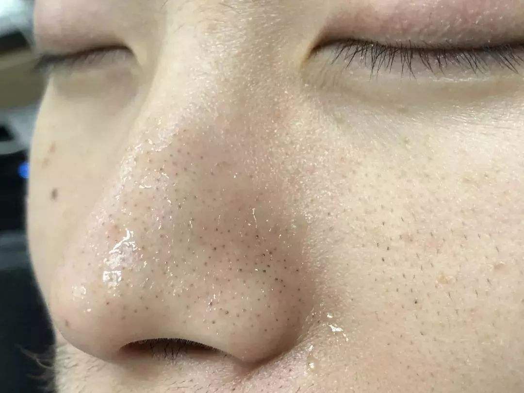 保湿效果好的清洁面膜排行榜,夏季清洁面膜去黑头