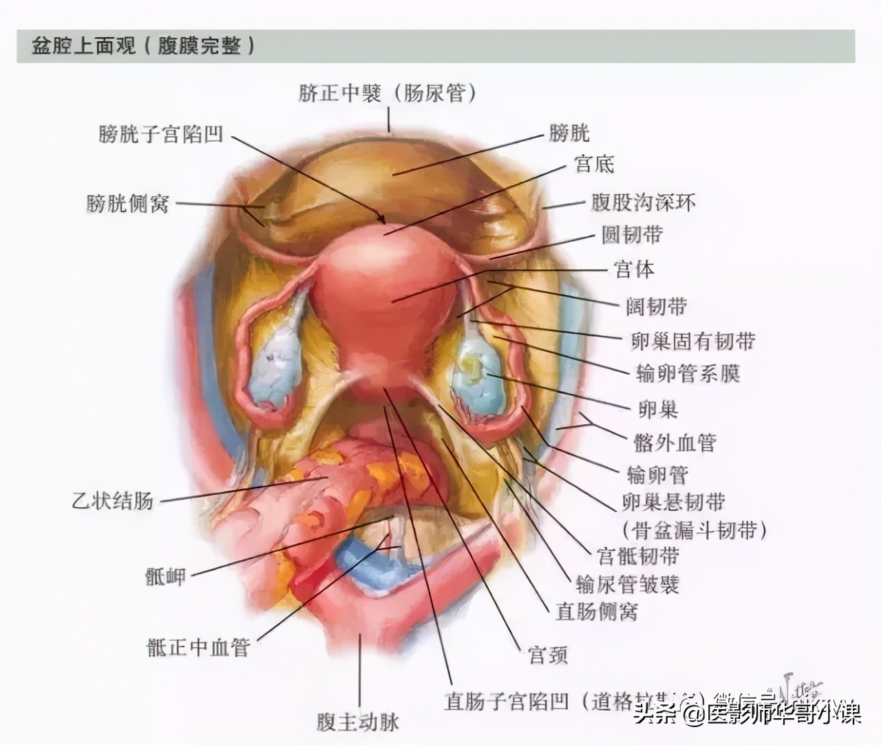 女性盆腔核磁解剖图谱,正常盆腔ct解剖图谱