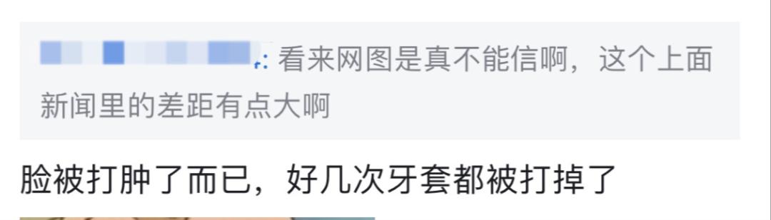 这样的“*力暴**萝莉”，丑吗？