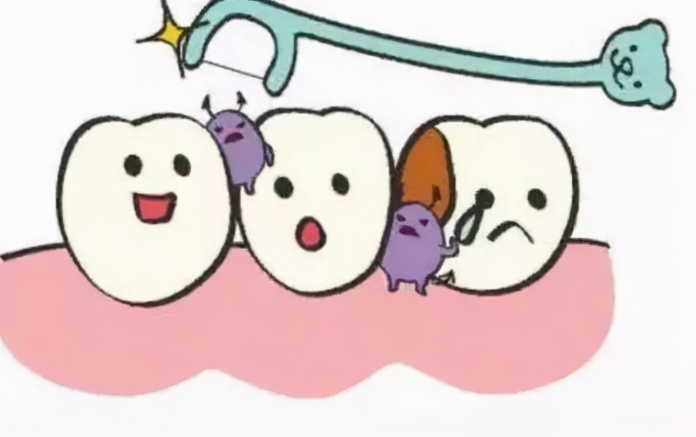 烤瓷牙牙齿缺失又不想种牙怎么办,有没有什么牙齿是不能做种植牙的