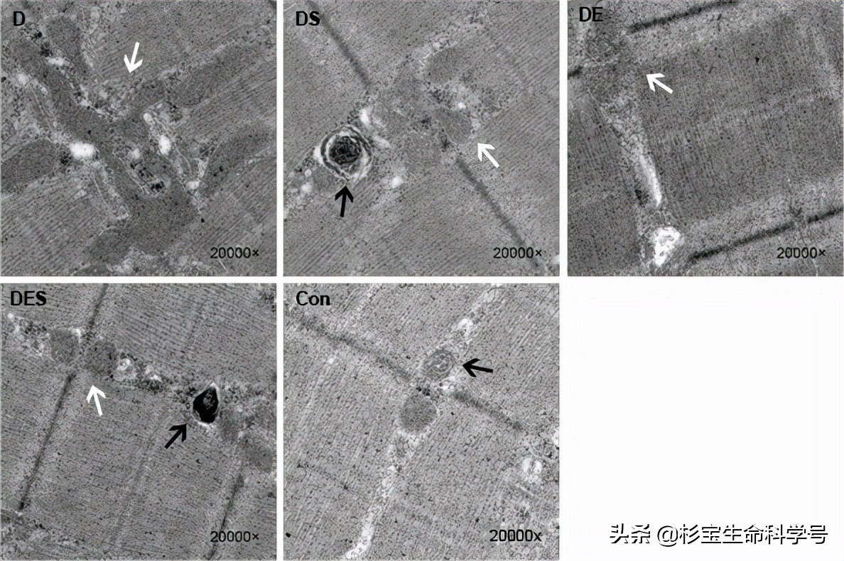亚精胺让细胞自噬,亚精胺诱导自噬的靶点