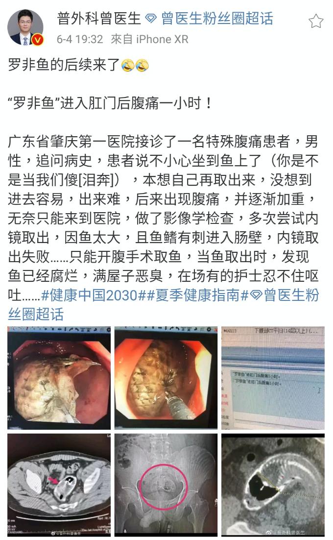 星医百可以长期吃吗,罗非鱼塞进直肠多长时间