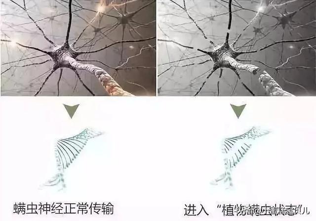 床单久睡不晒螨虫“成堆”？教你1招，不用洗不用晒，轻松除螨虫