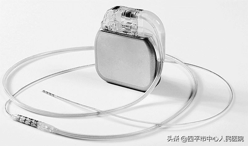 起搏器安装后要注意什么,加装心脏起搏器注意事项