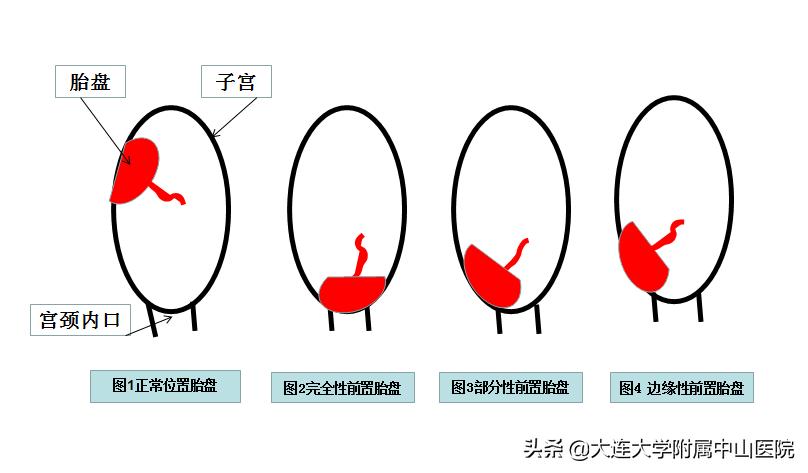 妈妈课堂孕期,妈妈课堂丨