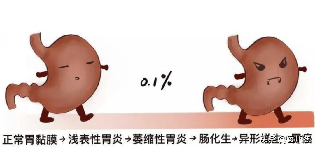 胃炎久治不愈查肿瘤标志物正常,胃炎一直拖着不治