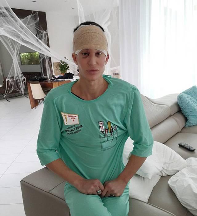 隆胸那些事你真的了解吗,隆胸加腹壁整形