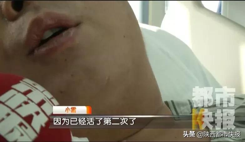 别乱吃了！陕西25岁小伙吃这种东西治痛风，引发多脏器衰竭医院下病危书......