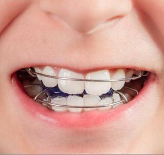 宝宝牙齿少是什么原因引起的,宝宝牙齿稀疏牙缝大是什么原因