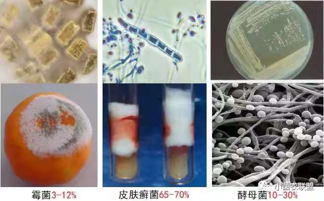 远离真菌,验方治愈一切真菌感染皮肤病