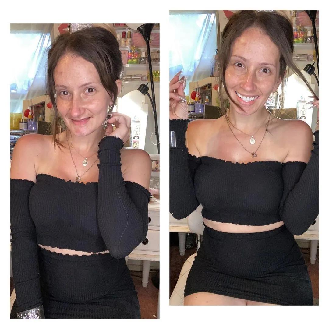 她21岁生娃，9年后牙齿掉光，卸妆惊呆网友：真实的自己最美