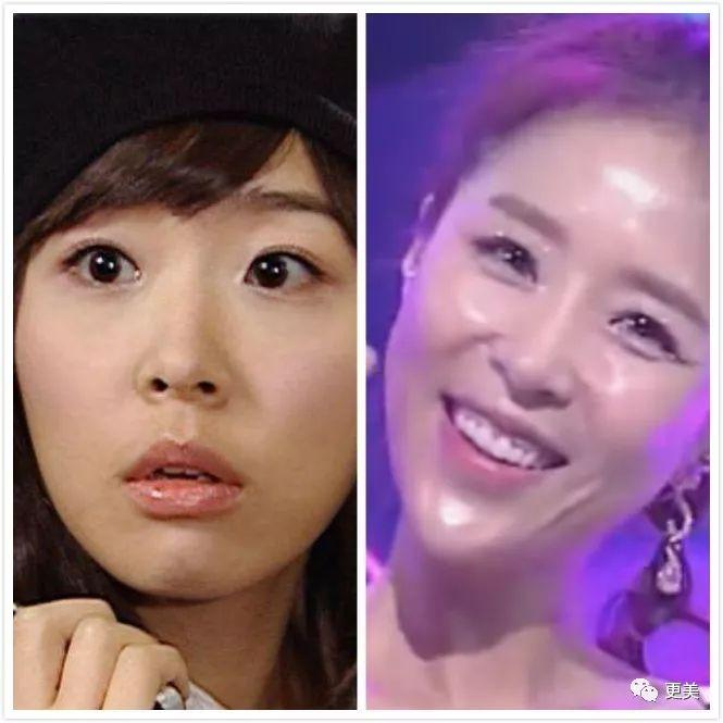 天后因队友吸du人气暴跌,公开承认整形却成蛇精下巴,瘦到脱相