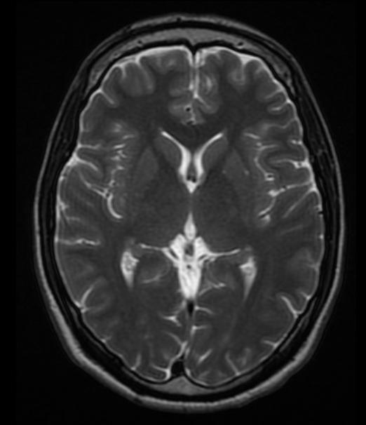 脑成像,脑成像技术是什么研究方法