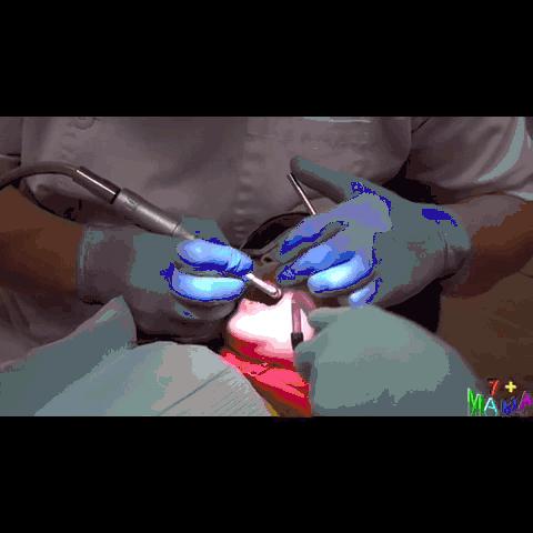 孩子牙菌斑怎么清除,孩子牙菌斑