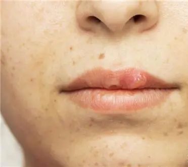 美白祛黄提亮肤色泡水喝,每天喝一杯可以美白淡斑清热解毒