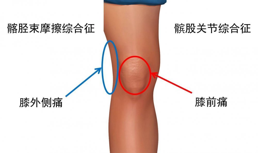 跑步对膝盖的正确训练,错误跑步姿势小腿疼怎么办