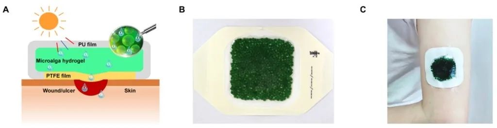 重磅！糖尿病皮肤溃疡伤口有望愈合|喵咖