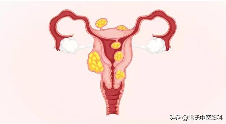 习惯性流产怎么样才能保胎河南,习惯性流产保胎最好的方法