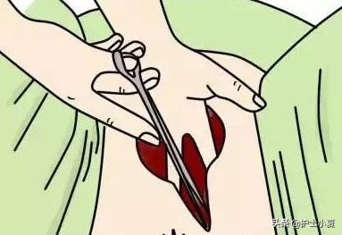 侧切产妇康复运动防止漏尿,产妇侧切减少运动