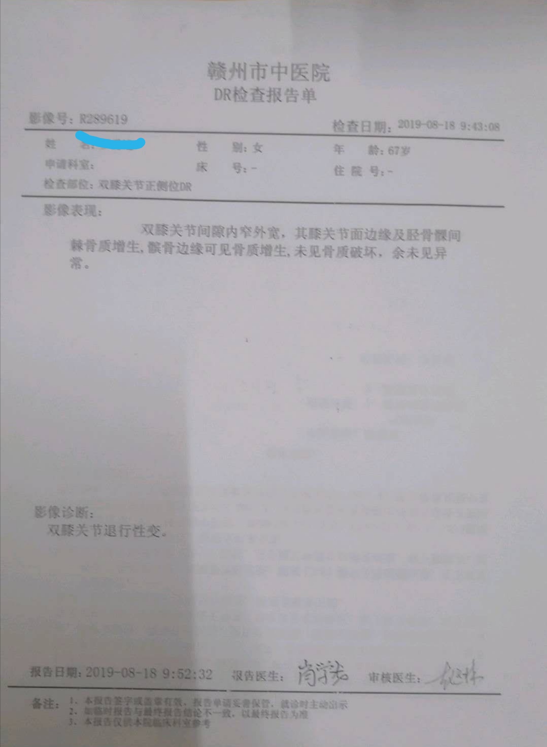 腰椎退行性变是正常的吗,腰椎骨质退行性变