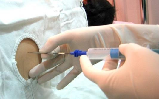 剖腹产为什么要用导尿管,剖腹产插导尿管的详细步骤