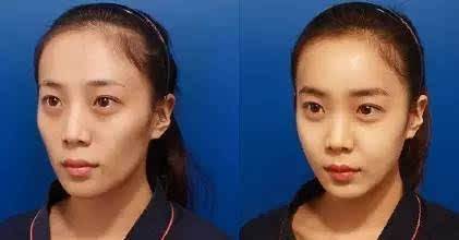 脸部凹陷怎么变饱满大小脸,脸颊凹陷怎么让脸胖起来